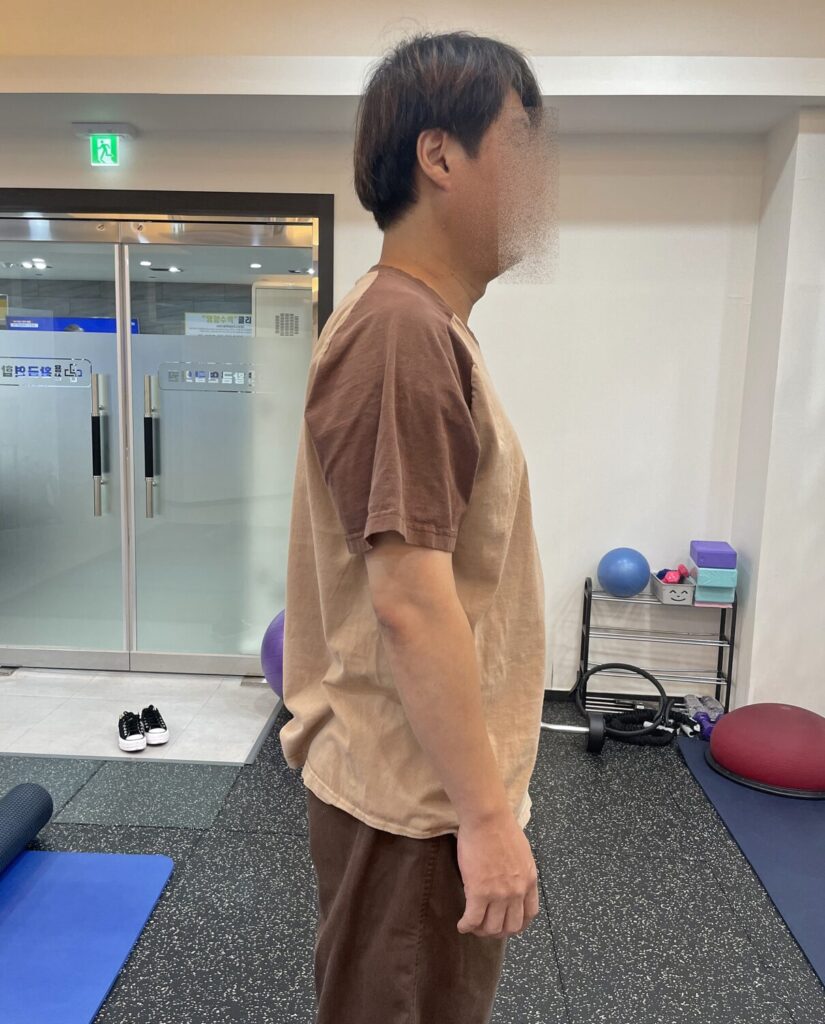 안동도수치료 전문 용상황금연합의원 도수치료
